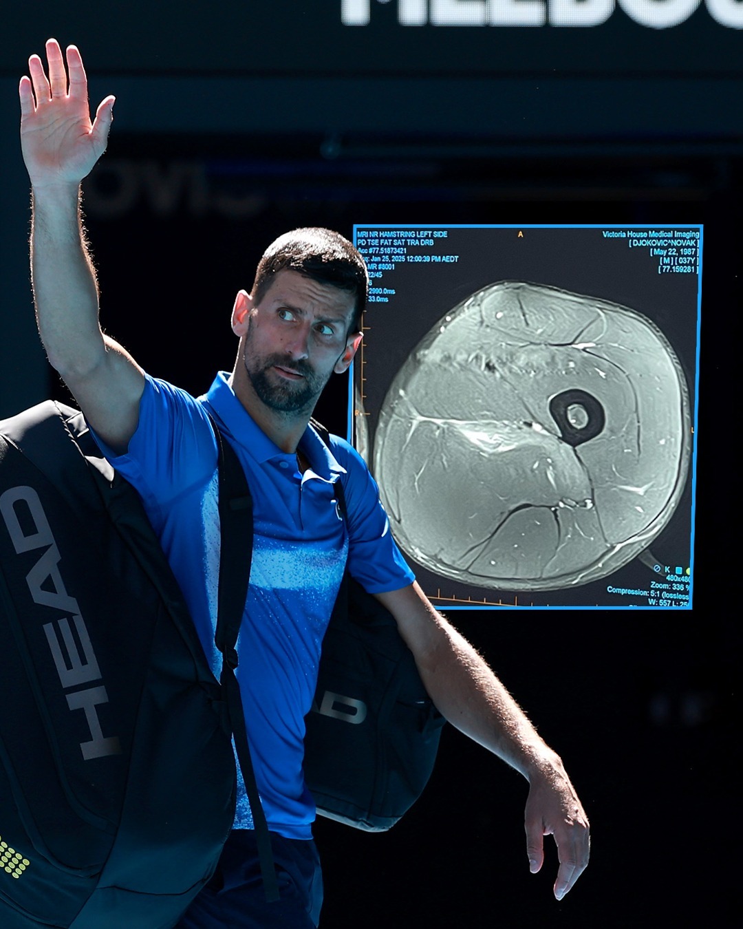 年终总决赛横扫澳网，德约科维奇状态火热